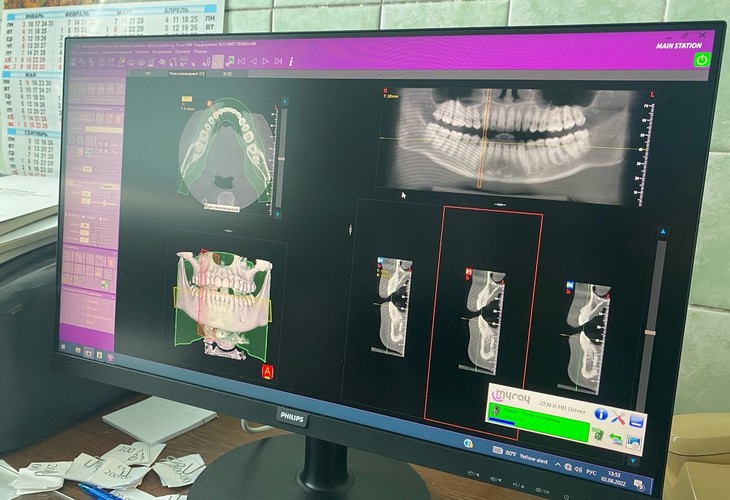 В стоматологической поликлинике Губкина появился 3D-томограф