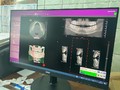 В стоматологической поликлинике Губкина появился 3D-томограф