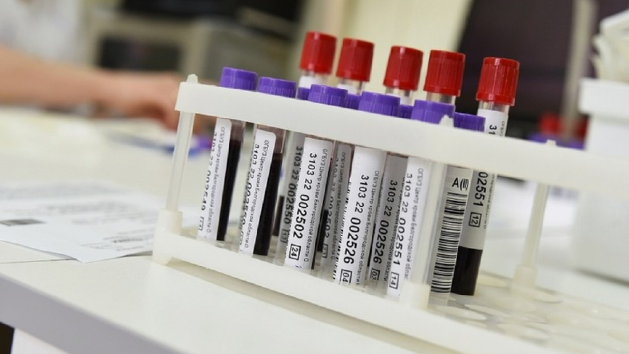 New payment rules for honorary donors in Russia